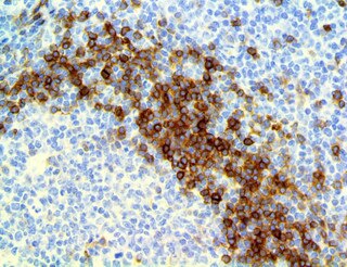 IHC of IgD on a FFPE Tonsil Tissue